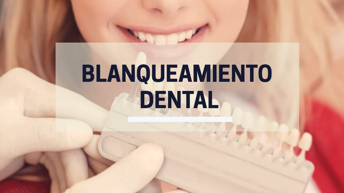 Blanqueamiento Dental